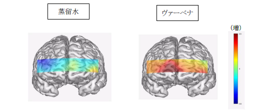 噴霧後3分経過時の、脳血流量画像(図1)