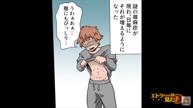 “20年間”続く体調不良…さらには“蕁麻疹”まで。病院に行くと⇒『原因がわかりました』原因不明の“病”の【正体】に驚き…！？