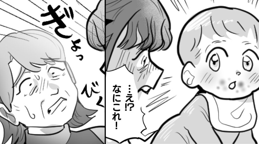 生後10ヶ月”卵アレルギー”の娘に…「卵舐めさせた」義母のせいで発疹が！？直後⇒ブチ切れた嫁の【宣告】に顔面蒼白！？