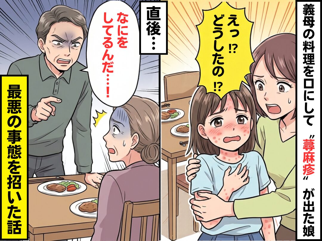 義母の出した料理を少し口にして“蕁麻疹”が出た娘！？直後⇒義父「なにをしてるんだ…！」最悪の事態を招いた話